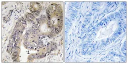 Anti-CAD (phospho Thr456) antibody used in IHC (Paraffin sections) (IHC-P). GTX55350