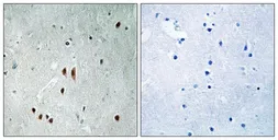 Anti-CNOT2 (phospho Ser101) antibody used in IHC (Paraffin sections) (IHC-P). GTX55366