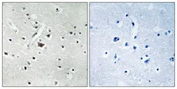 Anti-Phospholipase D2 (phospho Tyr169) antibody used in IHC (Paraffin sections) (IHC-P). GTX55368