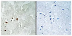 Anti-TIP60 (phospho Ser90) antibody used in IHC (Paraffin sections) (IHC-P). GTX55370