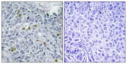 Anti-Topoisomerase II alpha (phospho Ser1106) antibody used in IHC (Paraffin sections) (IHC-P). GTX55437