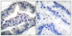 Anti-BIK (phospho Thr33) antibody used in IHC (Paraffin sections) (IHC-P). GTX55442