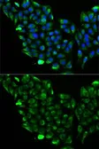 Anti-ACADS antibody used in Immunocytochemistry/ Immunofluorescence (ICC/IF). GTX55489