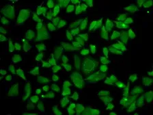 Anti-ALDH2 antibody used in Immunocytochemistry/ Immunofluorescence (ICC/IF). GTX55502