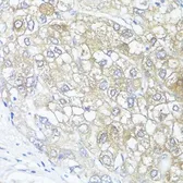 Anti-ASL antibody used in IHC (Paraffin sections) (IHC-P). GTX55520