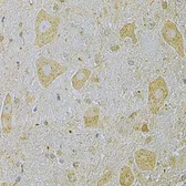 Anti-CaMKI gamma antibody used in IHC (Paraffin sections) (IHC-P). GTX55546