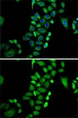 Anti-Glyoxalase I antibody used in Immunocytochemistry/ Immunofluorescence (ICC/IF). GTX55643