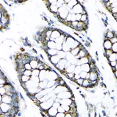Anti-Hexokinase II antibody used in IHC (Paraffin sections) (IHC-P). GTX55657