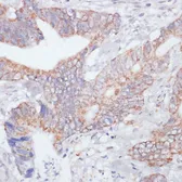 Anti-IKK epsilon antibody used in IHC (Paraffin sections) (IHC-P). GTX55673