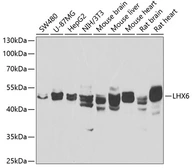 Anti-LHX6 antibody used in Western Blot (WB). GTX55690