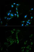 Anti-MVP/LRP antibody used in Immunocytochemistry/ Immunofluorescence (ICC/IF). GTX55715