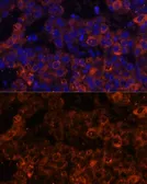 Anti-PAI-1 antibody used in IHC (Paraffin sections) (IHC-P). GTX55737