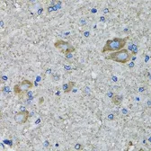 Anti-SSBP1 antibody used in IHC (Paraffin sections) (IHC-P). GTX55806