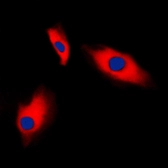Anti-gamma 2 Actin antibody used in Immunocytochemistry/ Immunofluorescence (ICC/IF). GTX55849