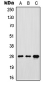 Anti-FOLR3 antibody used in Western Blot (WB). GTX55857