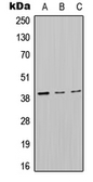 Anti-MT-ND2 antibody used in Western Blot (WB). GTX55870