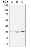Anti-BRMS1 antibody used in Western Blot (WB). GTX55940