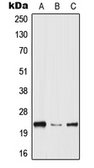 Anti-HPGDS antibody used in Western Blot (WB). GTX55947