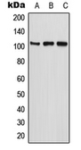 Anti-ETAA1 antibody used in Western Blot (WB). GTX55958