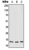 Anti-MT-ND3 antibody used in Western Blot (WB). GTX55994