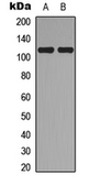 Anti-TOP3A antibody used in Western Blot (WB). GTX56078