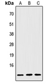 Anti-IGFL2 antibody used in Western Blot (WB). GTX56103