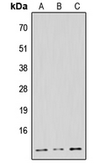 Anti-NDUFB1 antibody used in Western Blot (WB). GTX56109