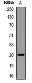 Anti-RNF138 antibody used in Western Blot (WB). GTX56117