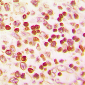 Anti-PAX1 antibody used in IHC (Paraffin sections) (IHC-P). GTX56136