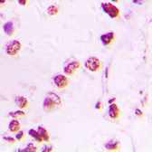 Anti-EP300 antibody used in IHC (Paraffin sections) (IHC-P). GTX56157