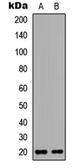 Anti-BinCARD antibody used in Western Blot (WB). GTX56220