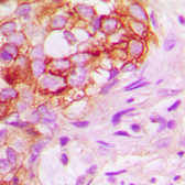 Anti-KSR1 antibody used in IHC (Paraffin sections) (IHC-P). GTX56241
