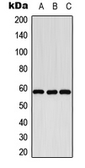 Anti-CYP8B1 antibody used in Western Blot (WB). GTX56292