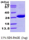 Human CBR4 protein, His tag. GTX57250-pro