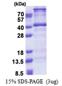 Human DNTTIP1 protein, His tag. GTX57303-pro