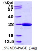 Human NCE2 protein, His tag. GTX57349-pro