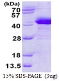 Human ZADH1 protein, His tag. GTX57356-pro