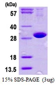 Human DNAJB8 protein, His tag. GTX57374-pro