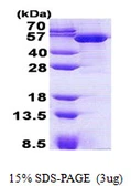 Human TBCEL protein, His tag. GTX57387-pro