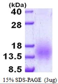 Mycobacterium tuberculosis ESAT6 protein, His tag. GTX57459-pro