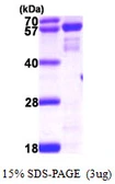 Human NMT2 protein, His tag. GTX57539-pro