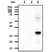 Anti-AK3 antibody [SJB3-36] used in Western Blot (WB). GTX57541