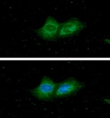 Anti-ACADS antibody [AT8B10] used in Immunocytochemistry/ Immunofluorescence (ICC/IF). GTX57702