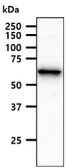 Anti-ACSF2 antibody [AT18B4] used in Western Blot (WB). GTX57705