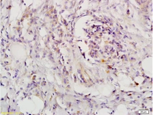 Anti-LIFR antibody used in IHC (Paraffin sections) (IHC-P). GTX60183