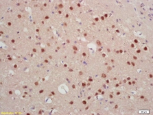 Anti-JARID2 antibody used in IHC (Paraffin sections) (IHC-P). GTX60262