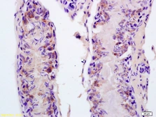 Anti-FASTKD5 antibody used in IHC (Paraffin sections) (IHC-P). GTX60304