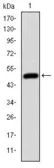 Anti-HFE antibody [3F1] used in Western Blot (WB). GTX60503