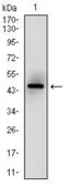 Anti-MSH6 antibody [5B11] used in Western Blot (WB). GTX60514