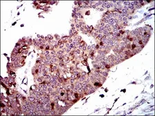 Anti-PBK antibody [2C8] used in IHC (Paraffin sections) (IHC-P). GTX60560